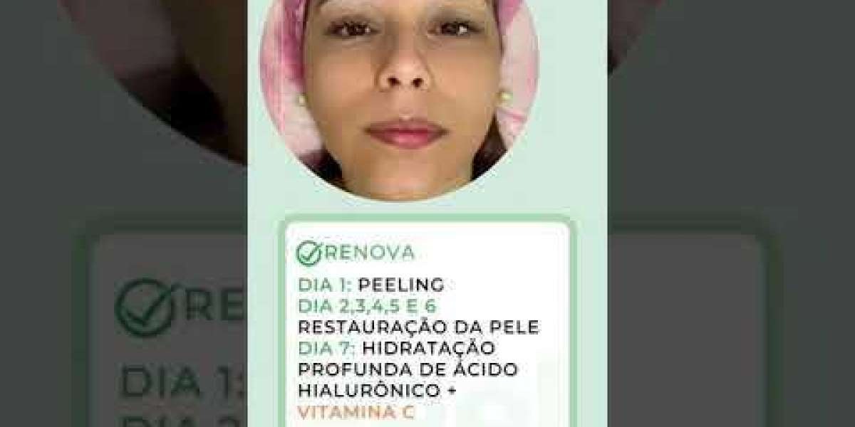 Transforme seu Olhar: Os Benefícios Surpreendentes do Botox na Sua Autoestima